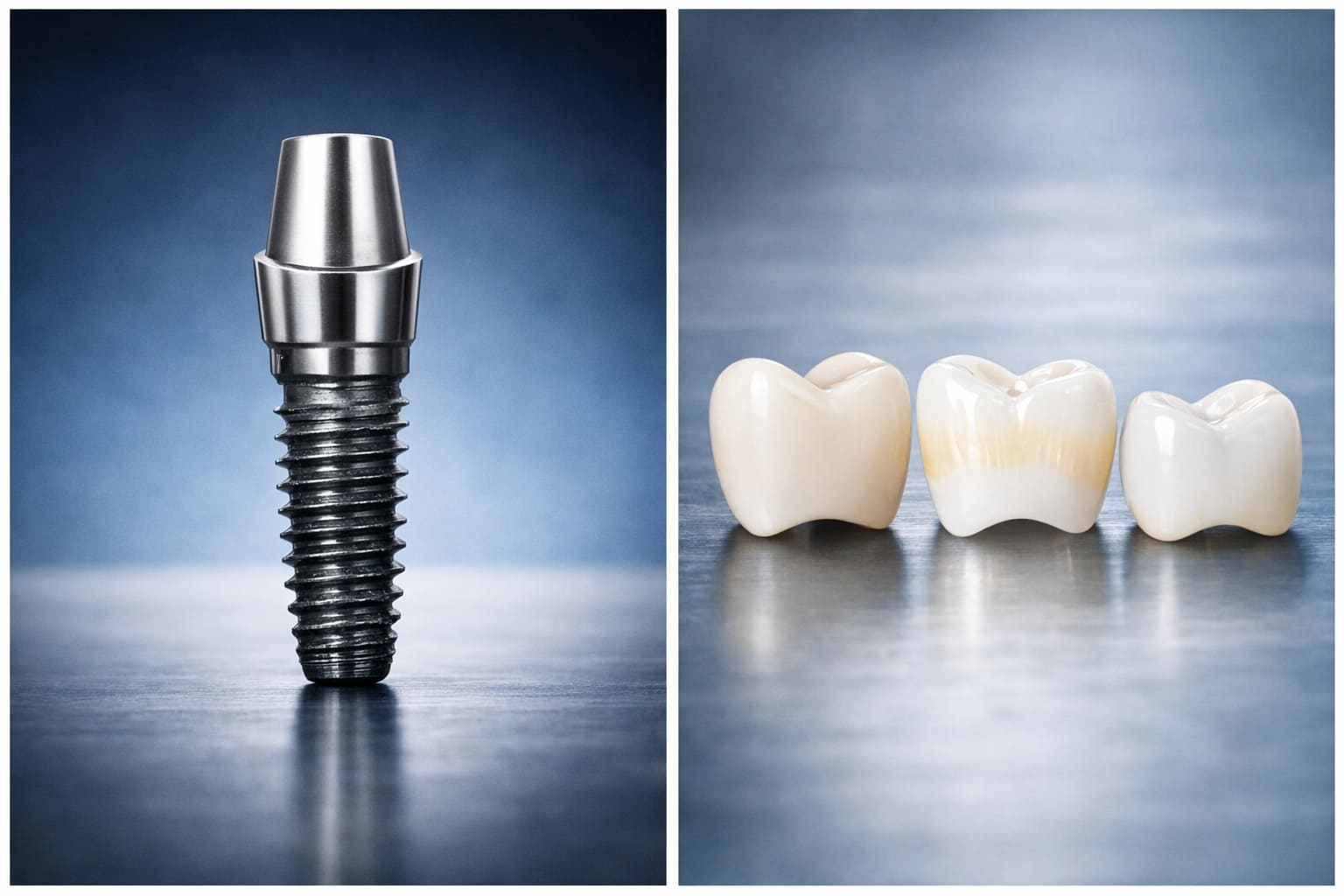 Сучасна стоматологія Луцьк — імплантація зубів